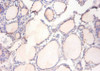 Immunohistochemistry of paraffin-embedded human thyroid tissue using CSB-PA01915A0Rb at dilution of 1:100