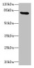 Western blot<br />
 All lanes: RAD17 antibody at 12µg/ml + Mouse thymus tissue<br />
 Secondary<br />
 Goat polyclonal to rabbit IgG at 1/10000 dilution<br />
 Predicted band size: 78, 76, 58, 67 kDa<br />
 Observed band size: 78 kDa<br />