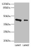 Western blot<br />
 All lanes: RAD23B antibody at 2µg/ml<br />
 Lane 1: 293T whole cell lysate<br />
 Lane 2: MCF-7 whole cell lysate<br />
 Secondary<br />
 Goat polyclonal to rabbit IgG at 1/10000 dilution<br />
 Predicted band size: 44, 36 kDa<br />
 Observed band size: 44 kDa<br />