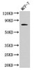 Western Blot<br />
 Positive WB detected in: MCF-7 whole cell lysate<br />
 All lanes: RAF1 antibody at 4µg/ml<br />
 Secondary<br />
 Goat polyclonal to rabbit IgG at 1/50000 dilution<br />
 Predicted band size: 74, 76 kDa<br />
 Observed band size: 74 kDa<br />