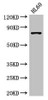 Western Blot<br />
 Positive WB detected in: HL60 whole cell lysate<br />
 All lanes: RARS antibody at 3.5µg/ml<br />
 Secondary<br />
 Goat polyclonal to rabbit IgG at 1/50000 dilution<br />
 Predicted band size: 76, 68 kDa<br />
 Observed band size: 76 kDa<br />