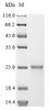 (Tris-Glycine gel) Discontinuous SDS-PAGE (reduced) with 5% enrichment gel and 15% separation gel.