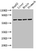 Western Blot<br />
 Positive WB detected in: HepG2 whole cell lysate, Rat liver tissue, Rat brain tissue, Rat stomach tissue<br />
 All lanes: RCBTB2 antibody at 3.2µg/ml<br />
 Secondary<br />
 Goat polyclonal to rabbit IgG at 1/50000 dilution<br />
 Predicted band size: 61, 58 kDa<br />
 Observed band size: 61 kDa<br />