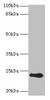 Western blot<br />
 All lanes: RCVRN antibody at 2µg/ml + Mouse eye tissue<br />
 Secondary<br />
 Goat polyclonal to rabbit IgG at 1/10000 dilution<br />
 Predicted band size: 24 kDa<br />
 Observed band size: 24 kDa<br />