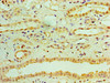 Immunohistochemistry of paraffin-embedded human kidney tissue using CSB-PA019523LA01HU at dilution of 1:100