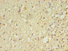 Immunohistochemistry of paraffin-embedded human brain tissue using CSB-PA019659LA01HU at dilution of 1:100