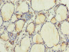 Immunohistochemistry of paraffin-embedded human thyroid tissue using CSB-PA019881LA01HU at dilution of 1:100