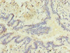 Immunohistochemistry of paraffin-embedded human lung tissue using CSB-PA019881LA01HU at dilution of 1:100
