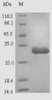 (Tris-Glycine gel) Discontinuous SDS-PAGE (reduced) with 5% enrichment gel and 15% separation gel.