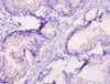 Immunohistochemistry of paraffin-embedded human prostate tissue using CSB-PA020067LA01HU at dilution of 1:10