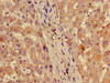 Immunohistochemistry of paraffin-embedded human liver tissue using CSB-PA020217ED01HU at dilution of 1:100