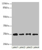 Western blot<br />
 All lanes: RPS8 antibody at 6µg/ml<br />
 Lane 1: HL60 whole cell lysate<br />
 Lane 2: THP-1 whole cell lysate<br />
 Lane 3: 293T whole cell lysate<br />
 Lane 4: Mouse liver tissue<br />
 Secondary<br />
 Goat polyclonal to rabbit IgG at 1/10000 dilution<br />
 Predicted band size: 25 kDa<br />
 Observed band size: 25 kDa<br />