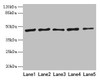 Western blot<br />
 All lanes: RRM2 antibody at 8µg/ml<br />
 Lane 1: HepG2 whole cell lysate<br />
 Lane 2: Jurkat whole cell lysate<br />
 Lane 3: Hela whole cell lysate<br />
 Lane 4: K562 whole cell lysate<br />
 Lane 5: 293T whole cell lysate<br />
 Secondary<br />
 Goat polyclonal to rabbit IgG at 1/10000 dilution<br />
 Predicted band size: 45, 52 kDa<br />
 Observed band size: 45 kDa<br />