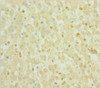 Immunohistochemistry of paraffin-embedded human liver tissue using CSB-PA020634HA01HU at dilution of 1:100 Immunohistochemistry of paraffin-embedded human liver tissue using CSB-PA020634HA01HU at dilution of 1:100