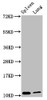 Western Blot<br />
 Positive WB detected in: Mouse spleen tissue, Mouse lung tissue<br />
 All lanes: S100a8 antibody at 3.8µg/ml<br />
 Secondary<br />
 Goat polyclonal to rabbit IgG at 1/50000 dilution<br />
 Predicted band size: 11 kDa<br />
 Observed band size: 11 kDa<br />