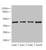 Western blot<br />
 All lanes: S1PR1 antibody at 2µg/ml<br />
 Lane 1: Jurkat whole cell lysate<br />
 Lane 2: A375 whole cell lysate<br />
 Lane 3: Mouse thymus tissue<br />
 Lane 4: HepG2 whole cell lysate<br />
 Secondary<br />
 Goat polyclonal to rabbit IgG at 1/10000 dilution<br />
 Predicted band size: 43 kDa<br />
 Observed band size: 43 kDa<br />