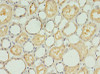 Immunohistochemistry of paraffin-embedded human kidney tissue using CSB-PA020650LA01HU at dilution of 1:100