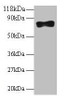 Western blot<br />
 All lanes: Samhd1 antibody at 2µg/ml + 293T whole cell lysate<br />
 Secondary<br />
 Goat polyclonal to rabbit IgG at 1/10000 dilution<br />
 Predicted band size: 76, 75 kDa<br />
 Observed band size: 76 kDa<br />