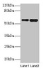 Western blot<br />
 All lanes: SCP2 antibody at 2µg/ml<br />
 Lane 1: A549 whole cell lysate<br />
 Lane 2: MCF-7 whole cell lysate<br />
 Secondary<br />
 Goat polyclonal to rabbit IgG at 1/10000 dilution<br />
 Predicted band size: 59, 16, 35, 51, 7, 55, 57 kDa<br />
 Observed band size: 59 kDa<br />