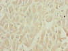 Immunohistochemistry of paraffin-embedded human heart tissue using CSB-PA021034LA01HU at dilution of 1:100