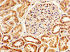 IHC image of CSB-PA021062EA01HU diluted at 1:800 and staining in paraffin-embedded human kidney tissue performed on a Leica BondTM system. After dewaxing and hydration, antigen retrieval was mediated by high pressure in a citrate buffer (pH 6.0) . Section was blocked with 10% normal goat serum 30min at RT. Then primary antibody (1% BSA) was incubated at 4°C overnight. The primary is detected by a biotinylated secondary antibody and visualized using an HRP conjugated SP system.