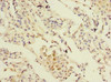 Immunohistochemistry of paraffin-embedded human lung tissue using CSB-PA021174LA01HU at dilution of 1:100