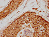 IHC image of CSB-PA021347LA01HU diluted at 1:700 and staining in paraffin-embedded human testis tissue performed on a Leica BondTM system. After dewaxing and hydration, antigen retrieval was mediated by high pressure in a citrate buffer (pH 6.0) . Section was blocked with 10% normal goat serum 30min at RT. Then primary antibody (1% BSA) was incubated at 4°C overnight. The primary is detected by a biotinylated secondary antibody and visualized using an HRP conjugated SP system.