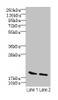 Western blot<br />
 All lanes: SKP1 antibody at 15µg/ml<br />
 Lane 1: Mouse brain tissue<br />
 Lane 2: Hela whole cell lysate<br />
 Secondary<br />
 Goat polyclonal to rabbit IgG at 1/10000 dilution<br />
 Predicted band size: 19 kDa<br />
 Observed band size: 19 kDa<br />