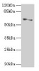 Western blot<br />
 All lanes: SLC1A6 antibody at 2µg/ml + A375 whole cell lysate<br />
 Secondary<br />
 Goat polyclonal to rabbit IgG at 1/10000 dilution<br />
 Predicted band size: 62, 35 kDa<br />
 Observed band size: 62 kDa<br />