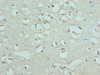 Immunohistochemistry of paraffin-embedded human brain tissue using CSB-PA021437LA01HU at dilution of 1:100