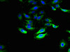 Immunofluorescent analysis of Hela cells using CSB-PA021539LA01HU at dilution of 1:100 and Alexa Fluor 488-congugated AffiniPure Goat Anti-Rabbit IgG (H+L)