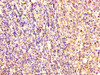 IHC image of CSB-PA02159A0Rb diluted at 1:300 and staining in paraffin-embedded human tonsil tissue performed on a Leica BondTM system. After dewaxing and hydration, antigen retrieval was mediated by high pressure in a citrate buffer (pH 6.0) . Section was blocked with 10% normal goat serum 30min at RT. Then primary antibody (1% BSA) was incubated at 4°C overnight. The primary is detected by a biotinylated secondary antibody and visualized using an HRP conjugated SP system.