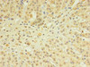 Immunohistochemistry of paraffin-embedded human adrenal gland tissue using CSB-PA022369HA01HU at dilution of 1:100