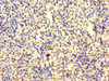 Immunohistochemistry of paraffin-embedded human spleen tissue using CSB-PA022674LA01HU at dilution of 1:100