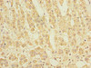 Immunohistochemistry of paraffin-embedded human adrenal gland tissue using CSB-PA022798LA01HU at dilution of 1:100