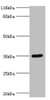 Western blot<br />
 All lanes: SULT1B1 antibody at 24µg/ml + Mouse small intestine tissue<br />
 Secondary<br />
 Goat polyclonal to rabbit IgG at 1/10000 dilution<br />
 Predicted band size: 35 kDa<br />
 Observed band size: 35 kDa<br />