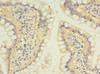 Immunohistochemistry of paraffin-embedded human small intestine tissue using CSB-PA022937EA01HU at dilution of 1:100