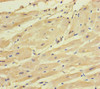 Immunohistochemistry of paraffin-embedded human heart tissue using CSB-PA022989LA01HU at dilution of 1:100