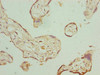 Immunohistochemistry of paraffin-embedded human placenta tissue using CSB-PA02325A0Rb at dilution of 1:100