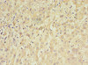 Immunohistochemistry of paraffin-embedded human liver tissue using CSB-PA023398LA01HU at dilution of 1:100