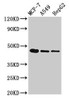 Western Blot<br />
 Positive WB detected in: MCF-7 whole cell lysate, A549 whole cell lysate, HepG2 whole cell lysate<br />
 All lanes: tgfb1 antibody at 3µg/ml<br />
 Secondary<br />
 Goat polyclonal to rabbit IgG at 1/50000 dilution<br />
 Predicted band size: 45 kDa<br />
 Observed band size: 45 kDa<br />