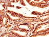 IHC image of CSB-PA023464LA01HU diluted at 1:300 and staining in paraffin-embedded human prostate tissue performed on a Leica BondTM system. After dewaxing and hydration, antigen retrieval was mediated by high pressure in a citrate buffer (pH 6.0) . Section was blocked with 10% normal goat serum 30min at RT. Then primary antibody (1% BSA) was incubated at 4°C overnight. The primary is detected by a biotinylated secondary antibody and visualized using an HRP conjugated SP system.