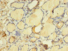 Immunohistochemistry of paraffin-embedded human thyroid tissue using CSB-PA023514LA01HU at dilution of 1:100