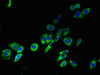 Immunofluorescent analysis of HepG2 cells using CSB-PA023615LA01HU at dilution of 1:100 and Alexa Fluor 488-congugated AffiniPure Goat Anti-Rabbit IgG (H+L)