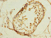 Immunohistochemistry of paraffin-embedded human testis tissue using CSB-PA023624LA01HU at dilution of 1:100 Immunohistochemistry of paraffin-embedded human testis tissue using CSB-PA023624LA01HU at dilution of 1:100