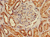 Immunohistochemistry of paraffin-embedded human kidney tissue using CSB-PA023736LA01HU at dilution of 1:100