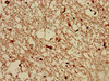 Immunohistochemistry of paraffin-embedded human brain tissue using CSB-PA023736LA01HU at dilution of 1:100