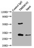 Immunoprecipitating TMEM192 in Jurkat whole cell lysate<br />
 Lane 1: Rabbit control IgG (1µg) instead of CSB-PA023784LA01HU in Jurkat whole cell lysate.
 For western blotting, a HRP-conjugated Protein G antibody was used as the secondary antibody (1/2000) <br />
 Lane 2: CSB-PA023784LA01HU (6µg) + Jurkat whole cell lysate (500µg) <br />
 Lane 3: Jurkat whole cell lysate (10µg) <br />