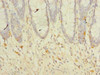 Immunohistochemistry of paraffin-embedded human colon tissue using CSB-PA023837LA01HU at dilution of 1:100