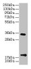 Western Blot<br />
 All lanes: TMEM91 antibody at 16µg/ml + A549 whole cell lysate<br />
 Secondary<br />
 Goat polyclonal to rabbit IgG at 1/10000 dilution<br />
 Predicted band size: 19, 16, 14, 15 kDa<br />
 Observed band size: 19, 34 kDa<br />